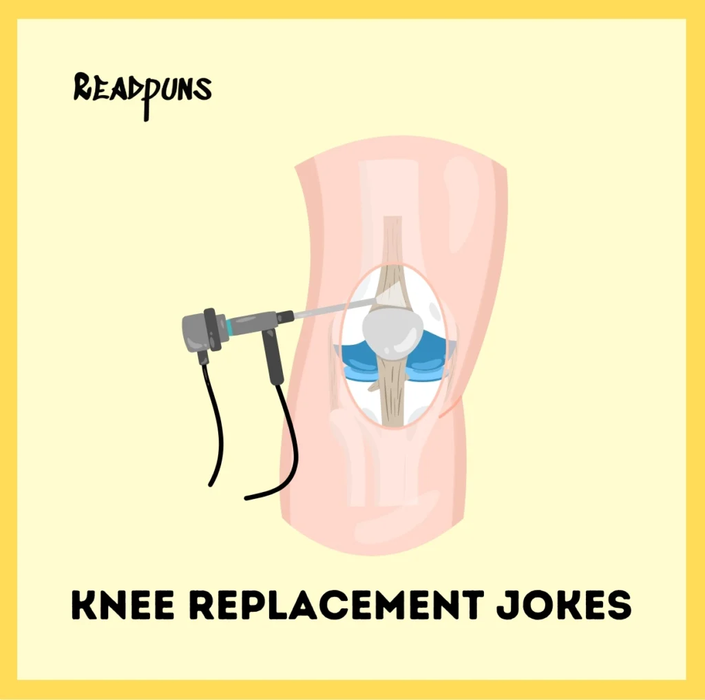 Knee Replacement Jokes