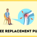 Knee Replacement Puns